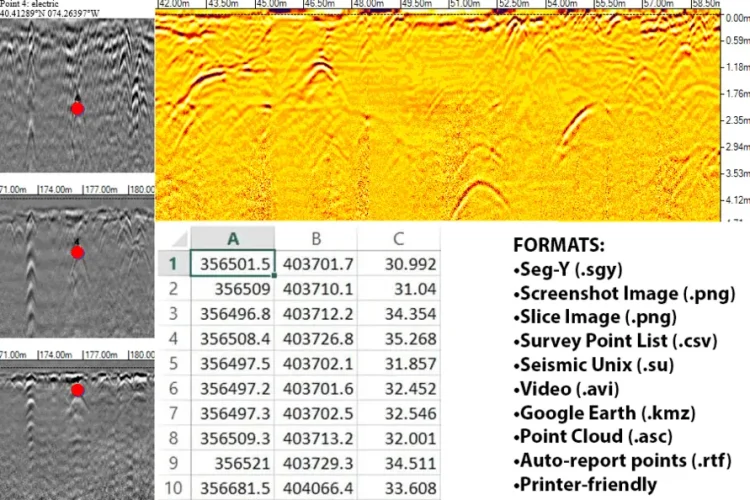 Enhance image at a particular depth of interest using time-varying gain. Apply various filters to manually configure gain settings.